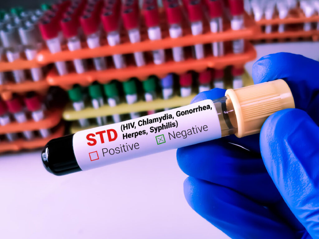 STD test sample
